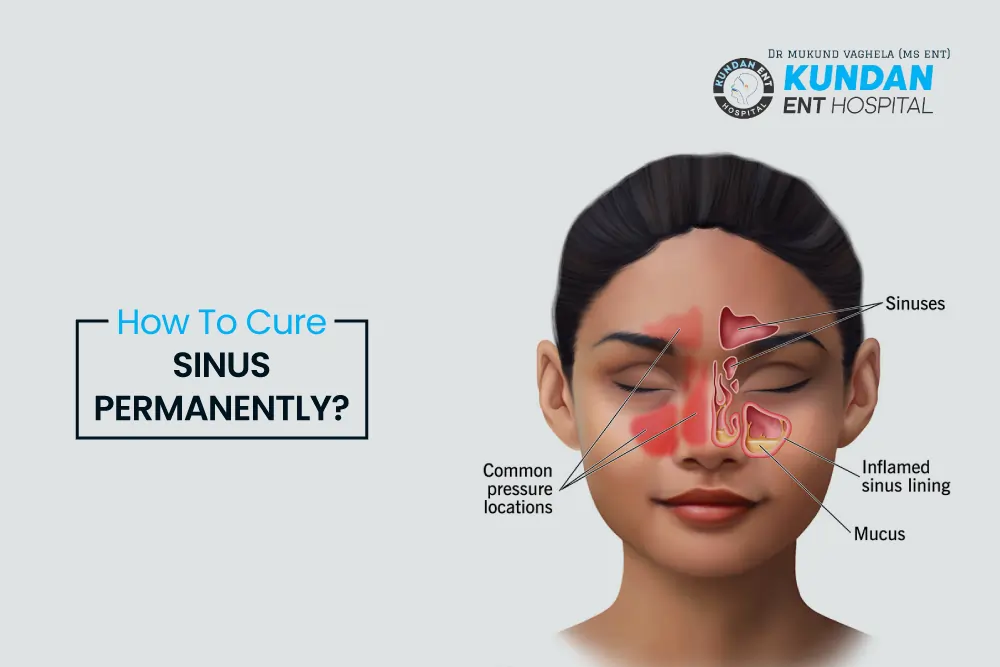 how-to-cure-sinus-permanently